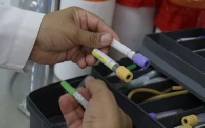 El tipo de alimentación es determinante en la aparición de cálculos renales: especialistas en medicina y nutrición.
