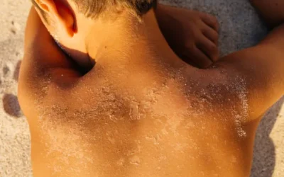 Espera Hospital Pediátrico casos de quemaduras y molusco contagioso en vacaciones